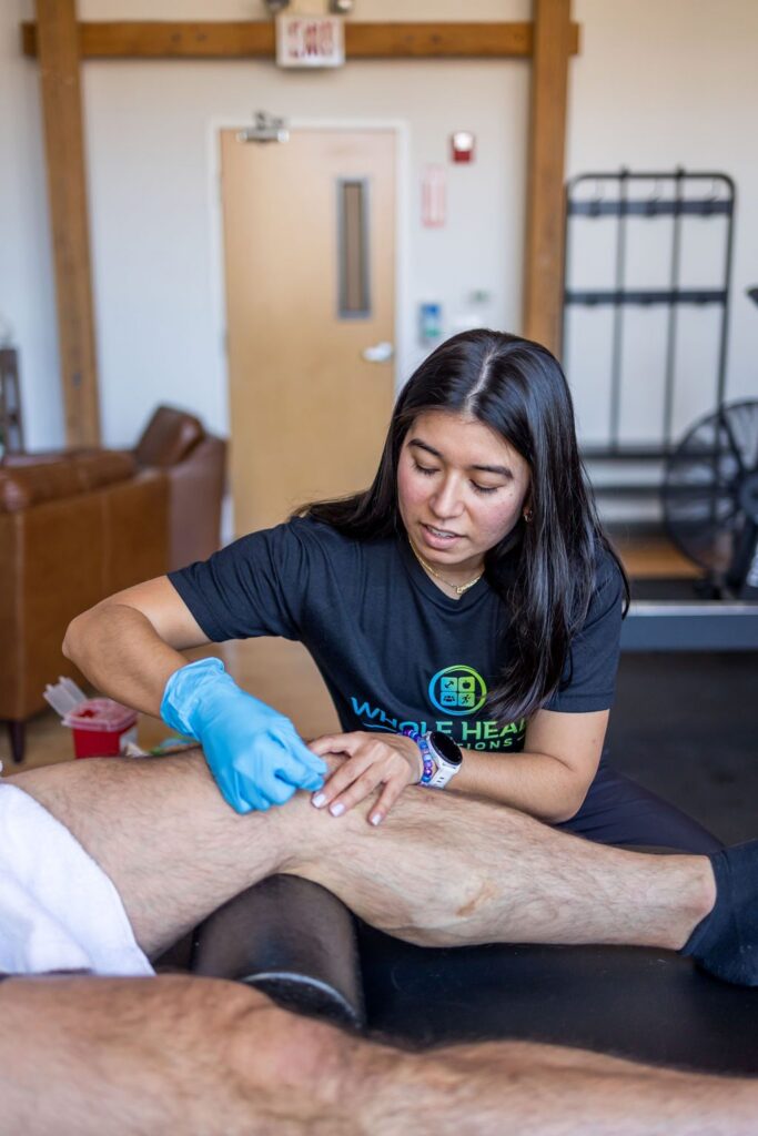 Physical therapist performing dry needling on a client's leg
